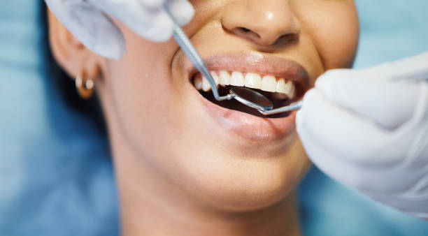 Best Emergency Broken Tooth Repair in Mason, MI