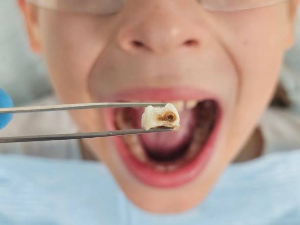Best Pediatric Emergency Dentist in Mason, MI